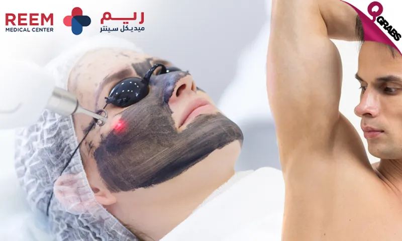 Carbon Laser Treatment for Face & Underarms at Reem Medical Center!